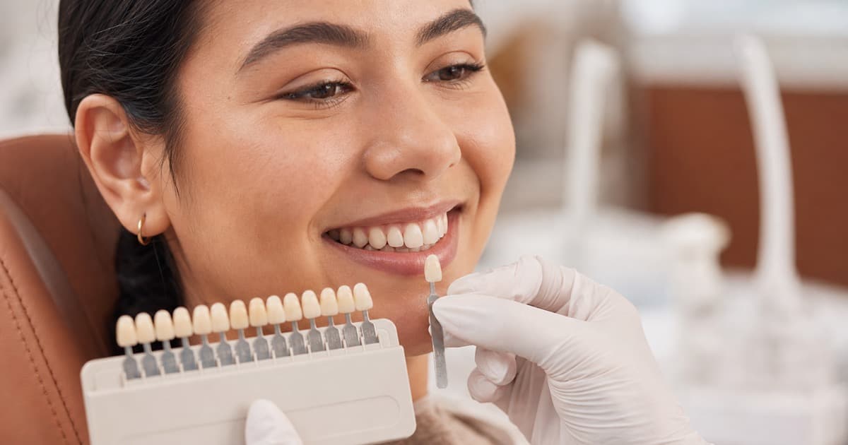 Selección del tono para una resina dental